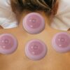 image0 (5) BLISS Cupping Therapy